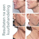 PRX - Therapie kuur - 4 behandelingen | Try Out Days